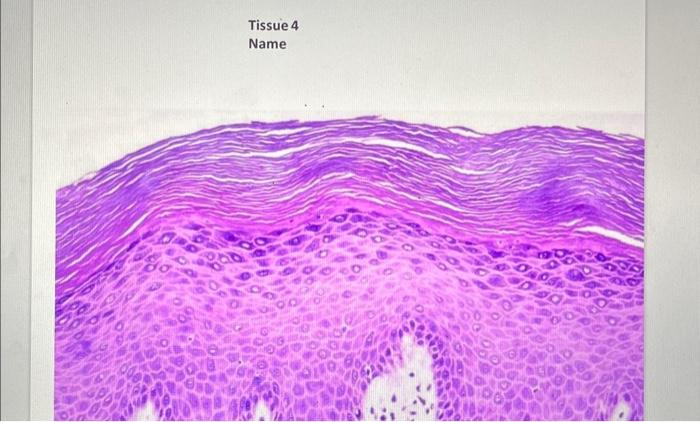 Solved Tissue 4 Name | Chegg.com