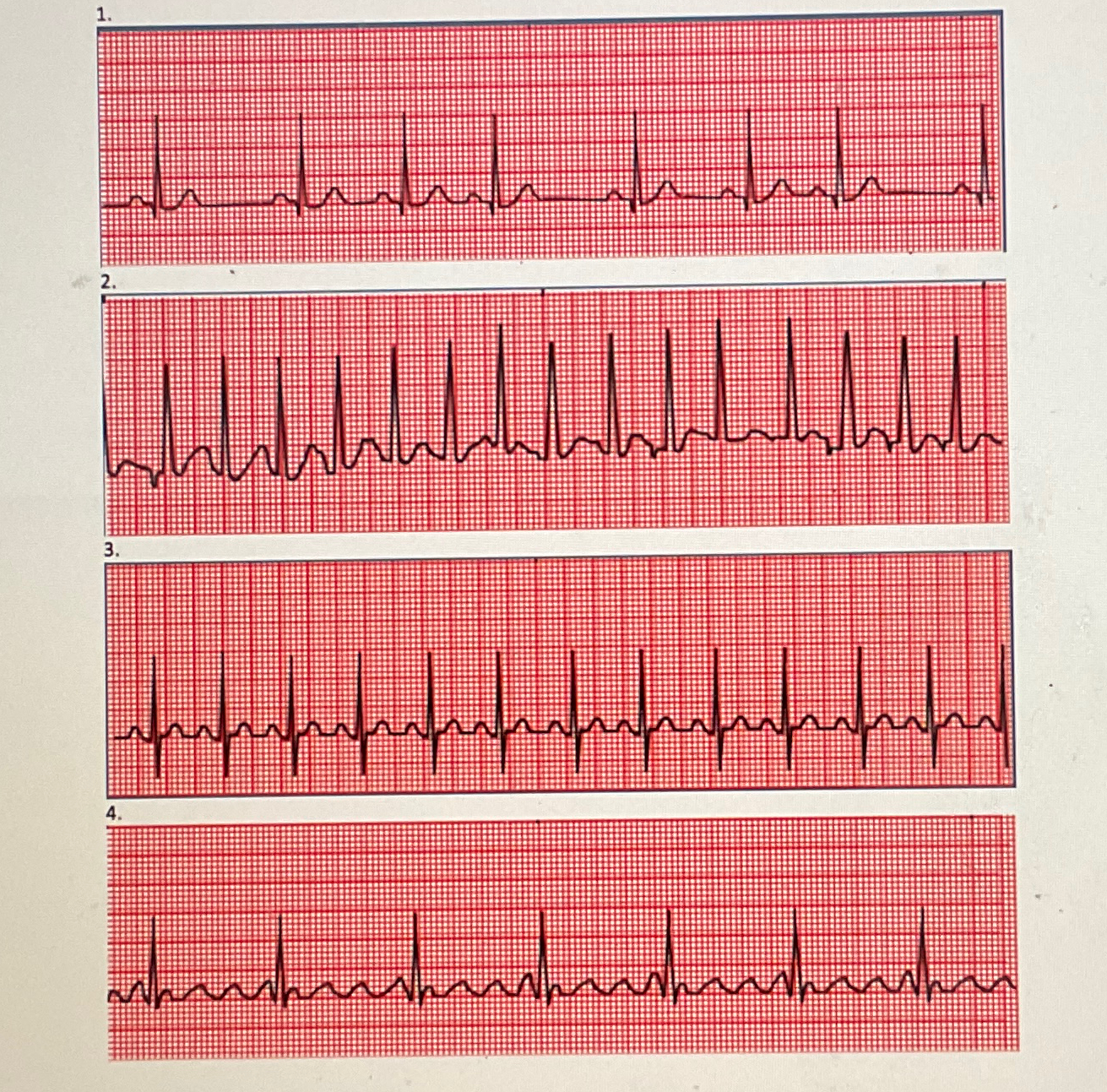 Solved Identify each rythem to identify the heart rate | Chegg.com