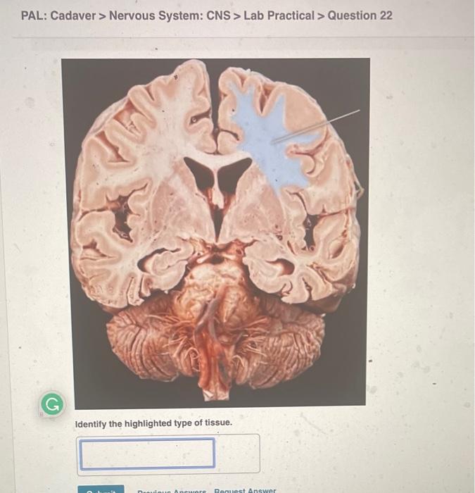 PAL: Cadaver > Nervous System: CNS > Lab Practical > Question 22
G
Identify the highlighted type of tissue.
Previous Apeworse