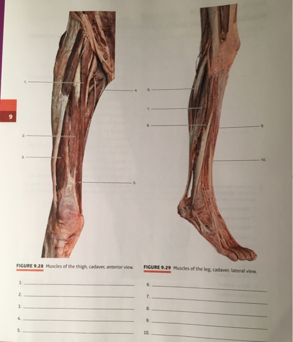 Solved TO FIGURE 9.28 Muscles of the thigh, cadaver,
