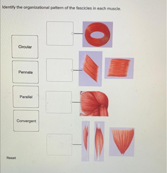 Solved Identify the organizational pattern of the fascicles