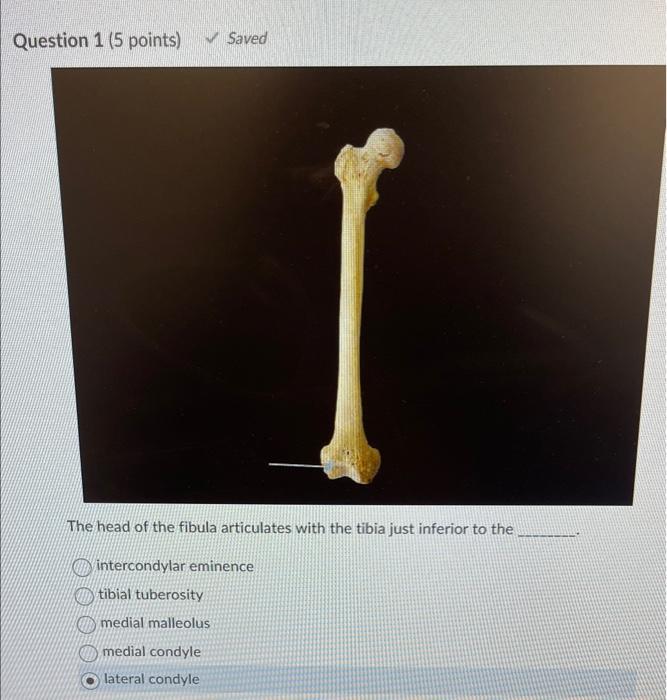 Solved The head of the fibula articulates with the tibia | Chegg.com