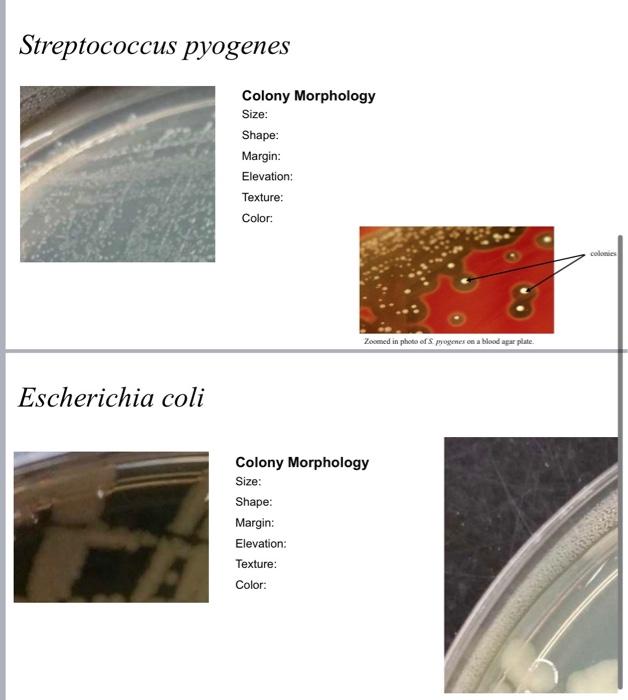 Bacillus Subtilis Colony Morphology Size Shape