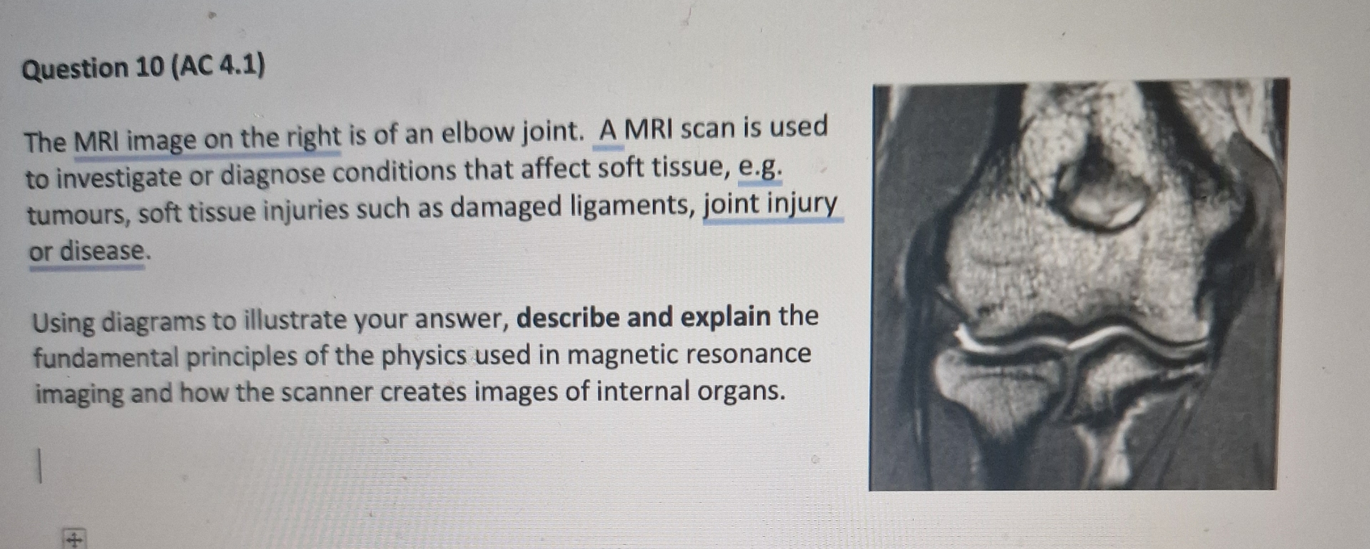 Solved Question 10 (AC 4.1)The MRI image on the right is of | Chegg.com