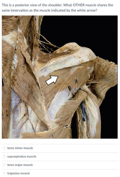 This is a posterior view of the shoulder. What OTHER muscle shares the same innervation as the muscle indicated by the white 