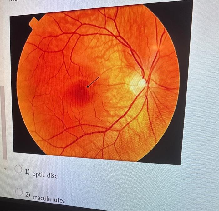 Solved 1) optic disc 2) macula lutea 3) central fovea 1)