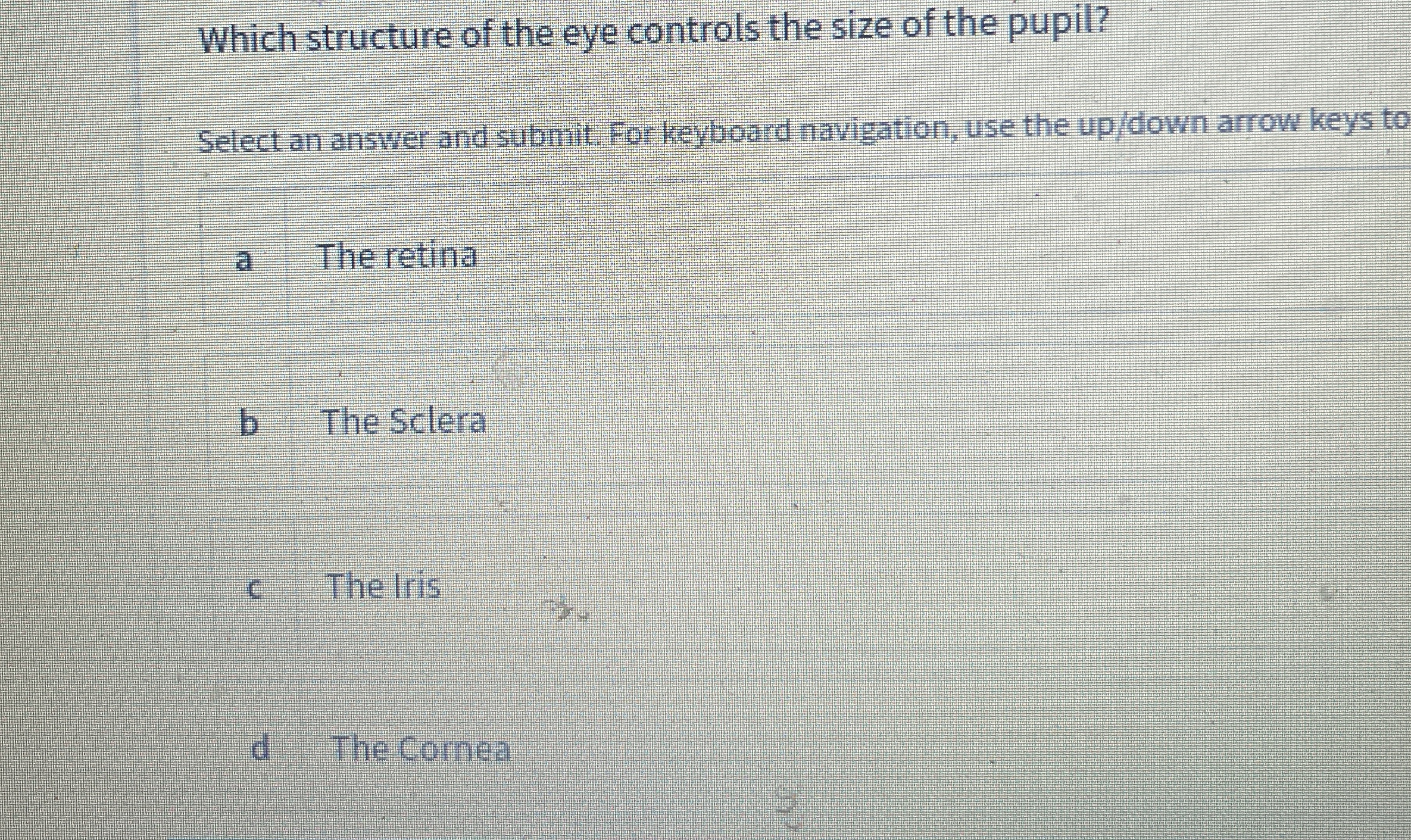Solved Which structure of the eye controls the size of the | Chegg.com
