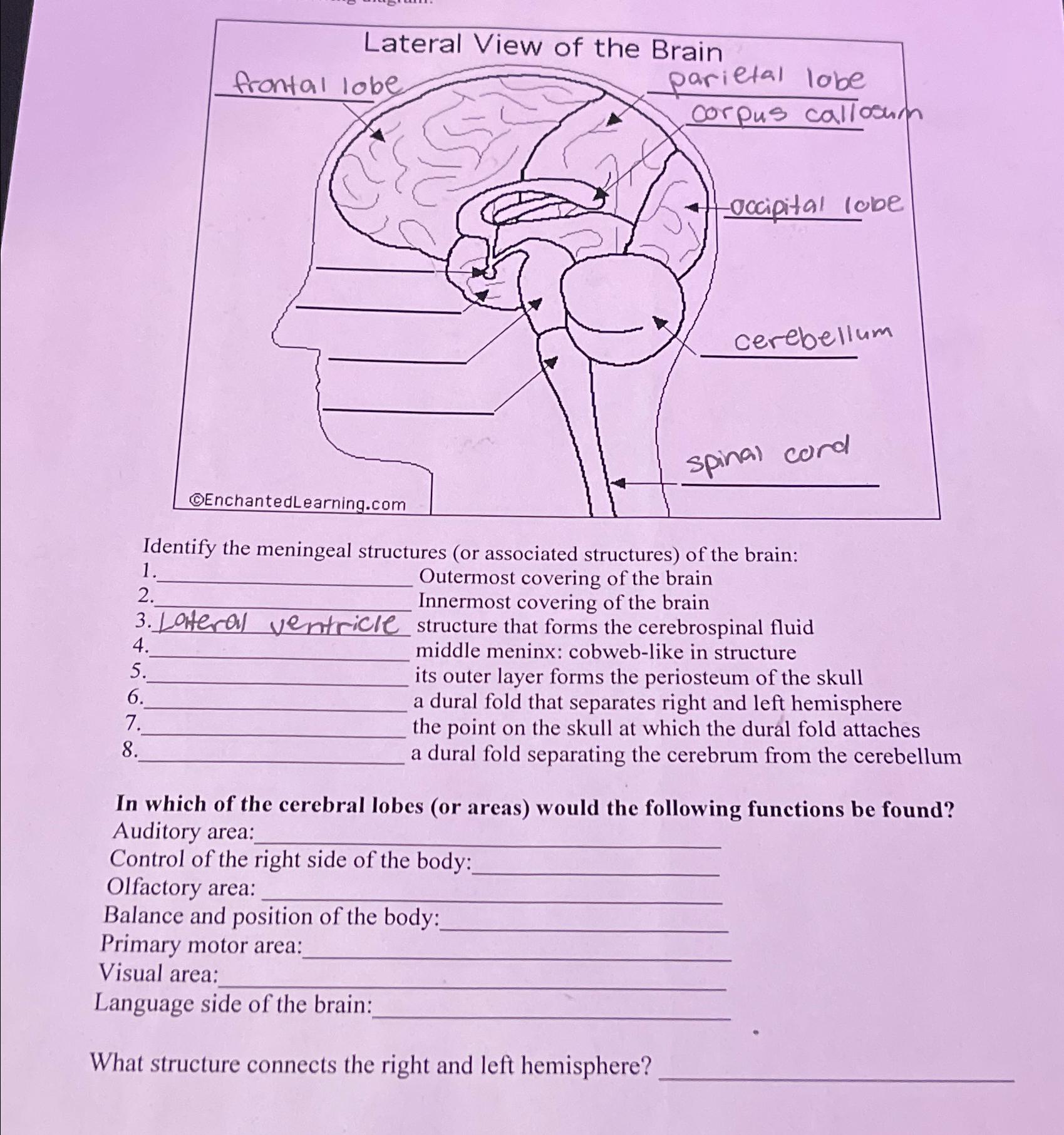 solved-identify-the-meningeal-structures-or-associated-chegg