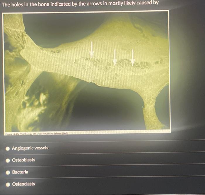 Solved The holes in the bone indicated by the arrows in