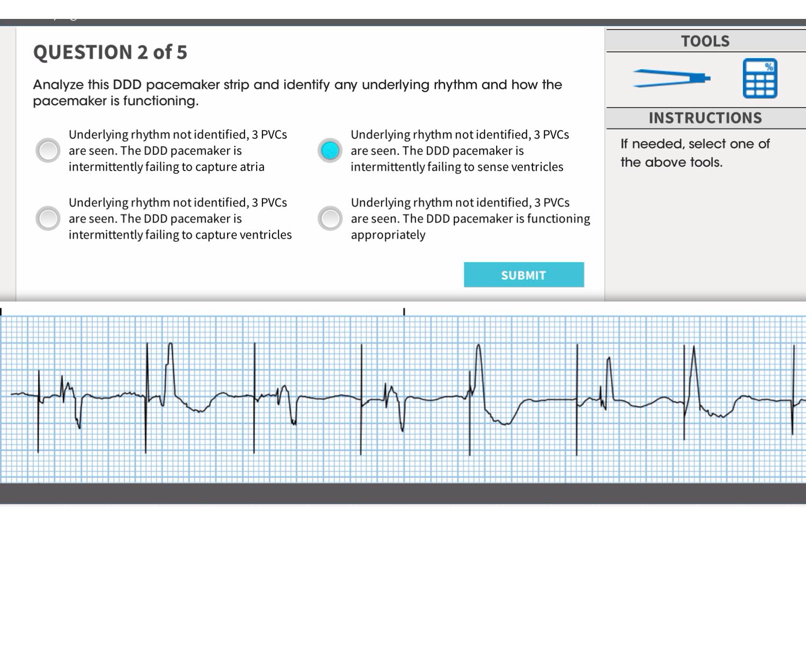 Solved QUESTION 2 ﻿of 5Analyze this DDD pacemaker strip and