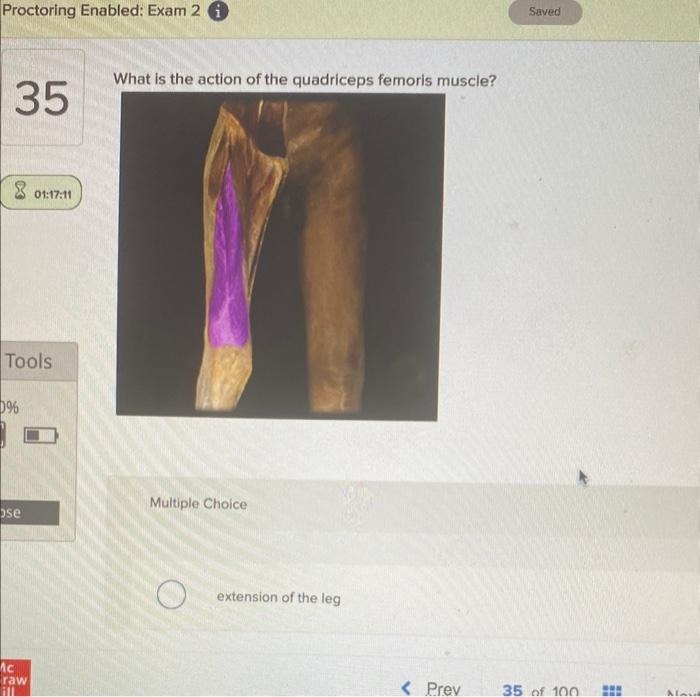 Solved What is the action of the quadriceps femoris muscle?