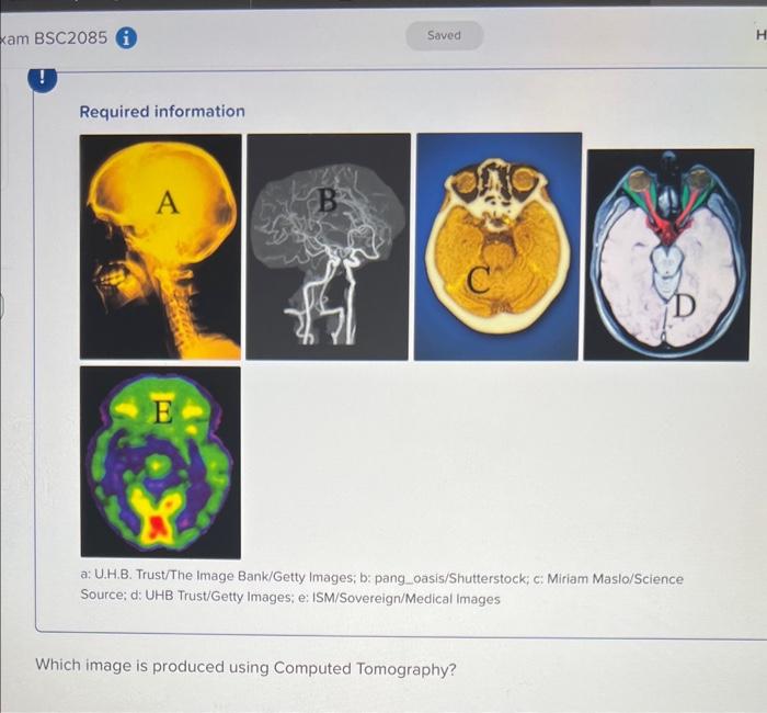 Solved Required information a: U.H.B. Trust/The Image | Chegg.com