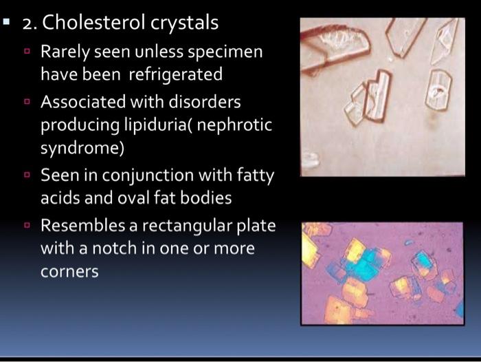cholesterol crystals in urine polarized
