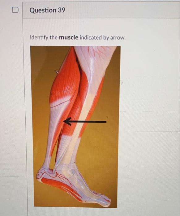 [Solved] Identify the muscle indicated by yellow arrow. I