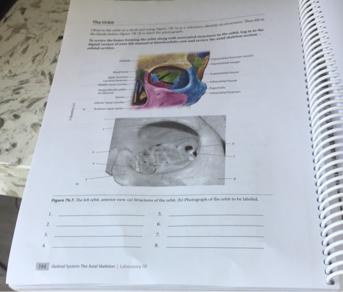 Solved The Orbe OOOOOO Figure 7.7. The left orbit, anterior | Chegg.com