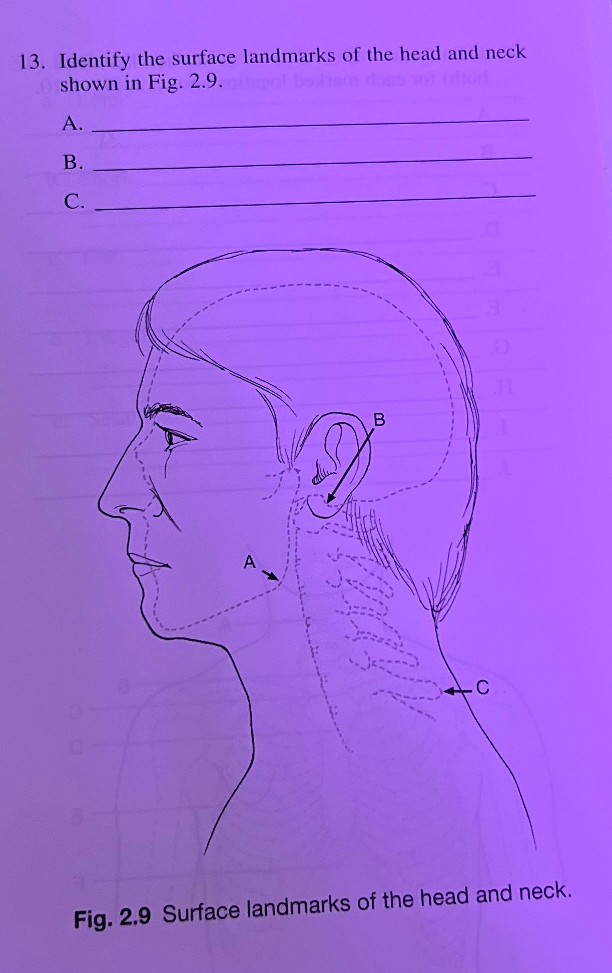 Solved Identify the surface landmarks of the head and neck | Chegg.com