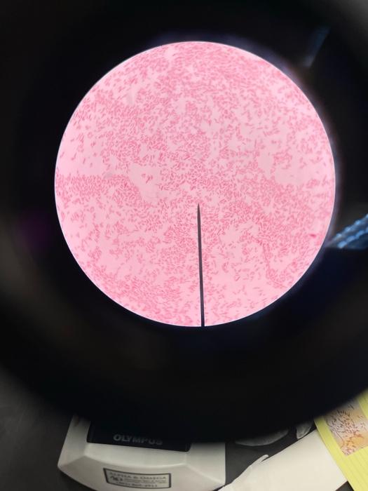 Solved OLYMPUS Neisseria sicca Serratia marcescens | Chegg.com