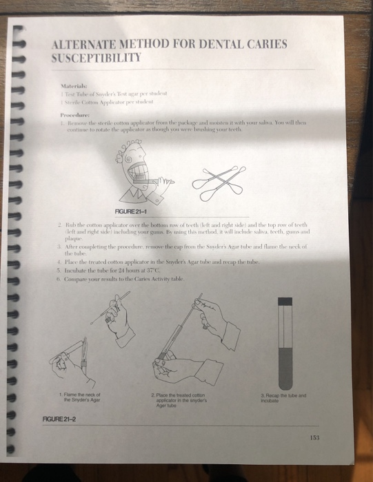 Solved ALTERNATE METHOD FOR DENTAL CARIES SUSCEPTIBILITY