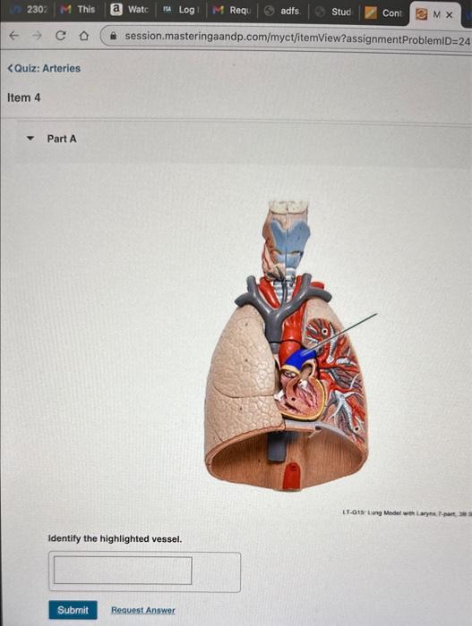 Solved Identify The Highlighted Vessel. | Chegg.com