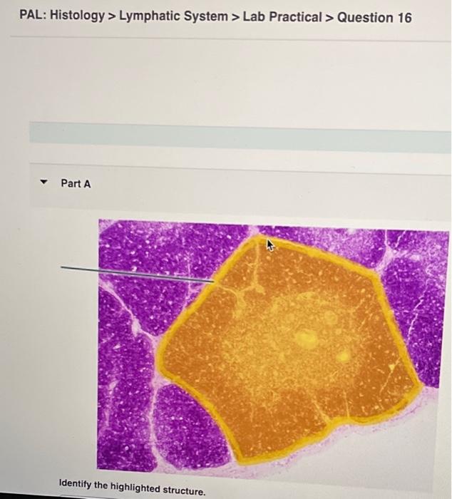 Solved PAL: Histology &gt; Lymphatic System &gt; Lab Practical &gt; | Chegg.com