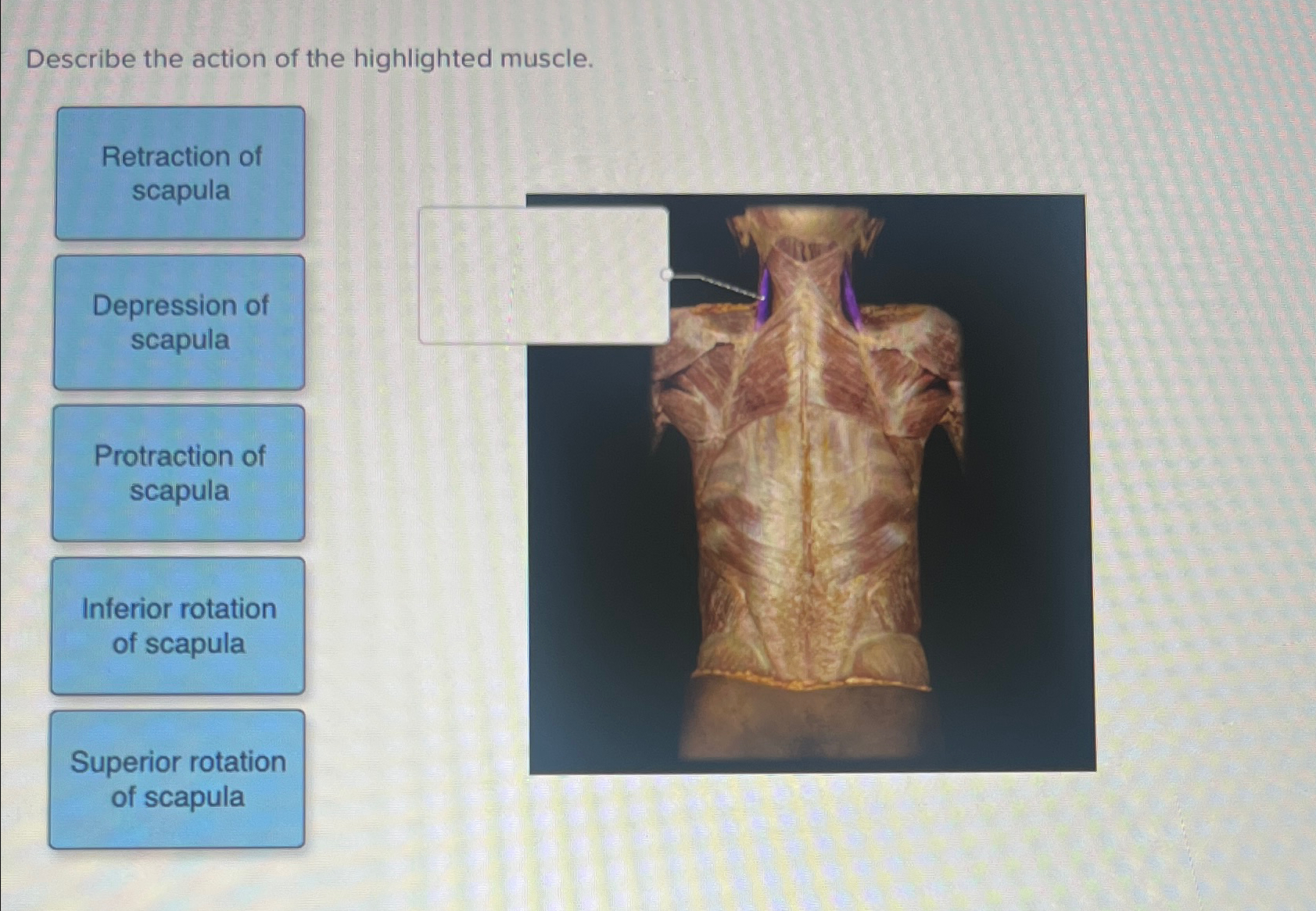 Solved Describe the action of the highlighted