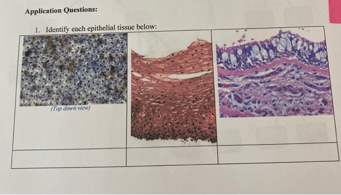 Solved Application Questions: 1. Identify each epithelial | Chegg.com