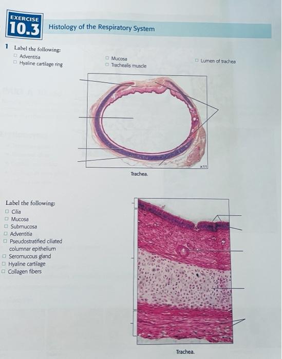 EXERCISE
10.3 Histology of the Respiratory System
1 Label the following:
Adventitia
Mucosa
Tracheals muscle
Hyaline cartilage