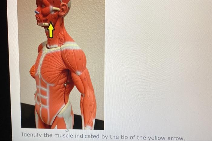Solved Identify the muscle indicated by the tip of the | Chegg.com