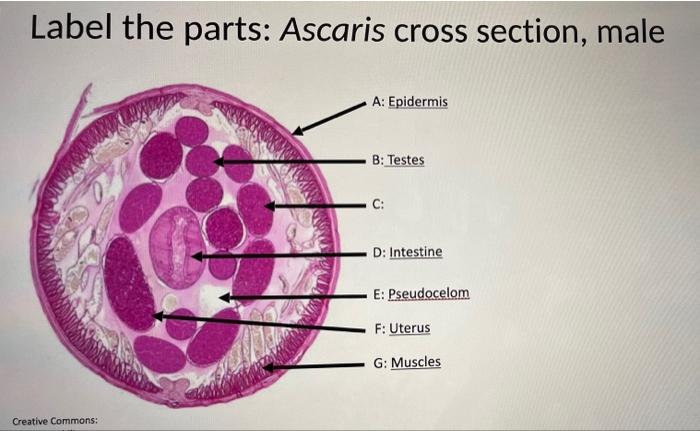 ascaris lumbricoides male and female