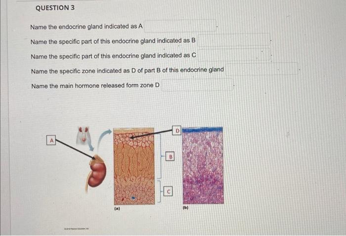 QUESTION 3 Name The Endocrine Gland Indicated As A | Chegg.com