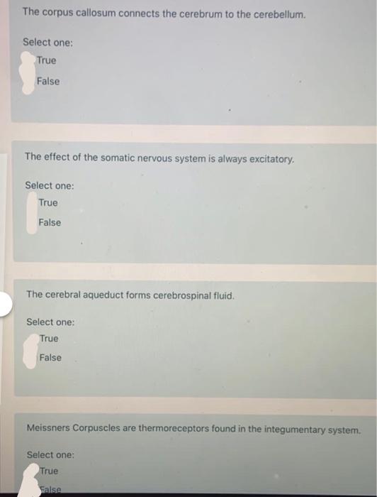 Solved The corpus callosum connects the cerebrum to the | Chegg.com