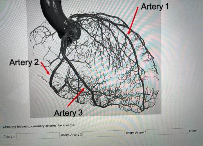 Artery 1 Artery 2 Artery 3 Label the following coronary arteries, be specific artery artery. Artery 3 Artery 1 artery. Artery