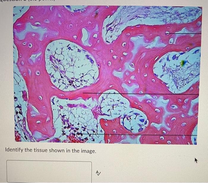 Solved Identify The Tissue Shown In The Image. A- B | Chegg.com