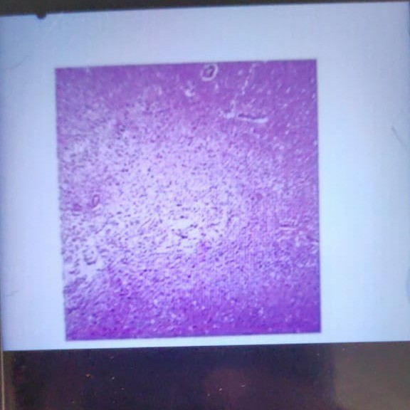 Solved 1) Name and explain the given specimen and what is