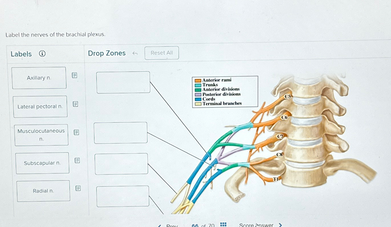 Solved Label The Nerves Of The Brachial Plexuslabelsidrop 0101