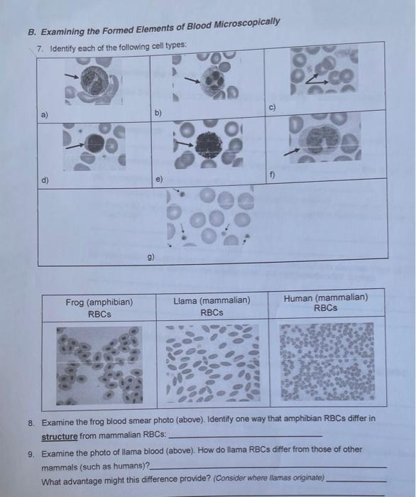 Solved B. Examining The Formed Elements Of Blood | Chegg.com