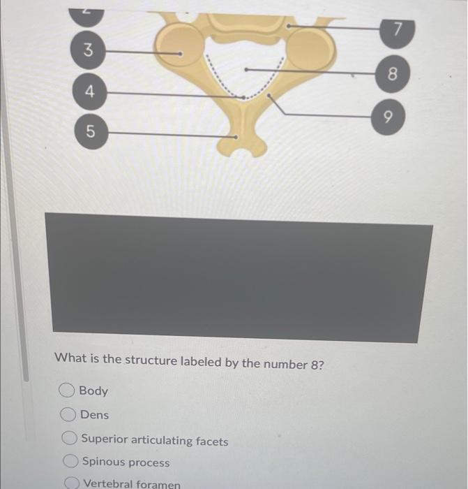 Solved The cervical vertebrae are the only vertebrae to have | Chegg.com