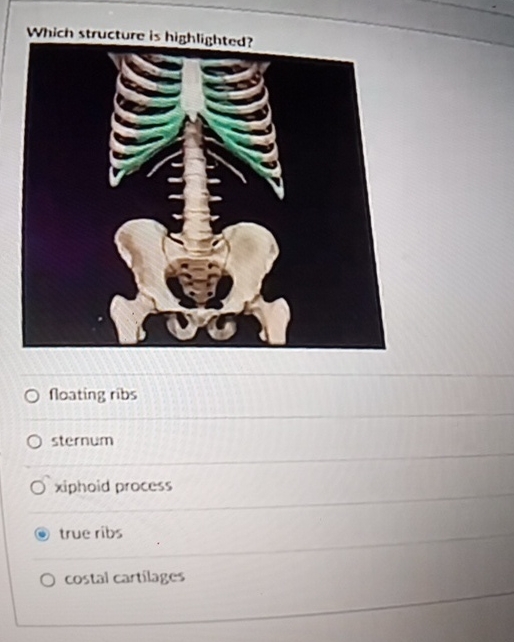 Floating Ribs In Python Solved Which structure is highlighted?floating | Chegg.com