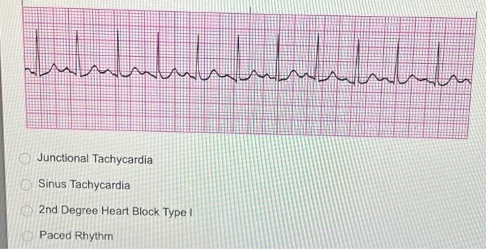 Solved 2nd Degree Heart Block Type II Sinus Rhythm with PJC | Chegg.com