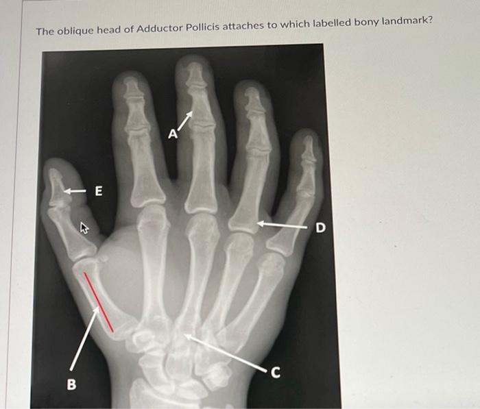 The oblique head of Adductor Pollicis attaches to which labelled bony landmark?
B
E
4-
C
D