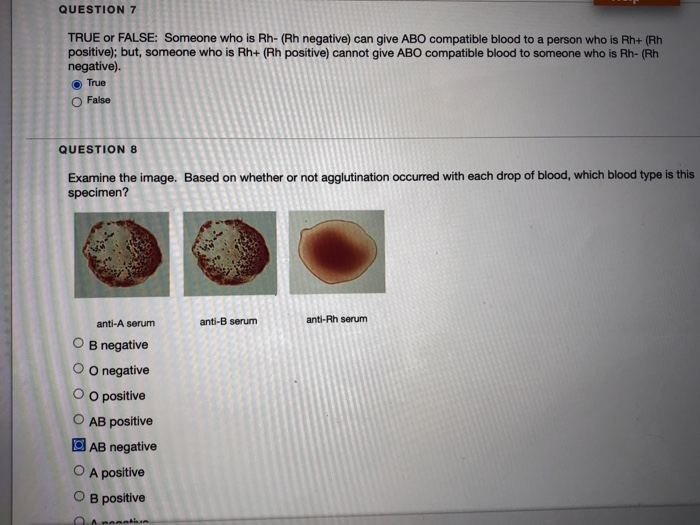 Solved QUESTION 1 TRUE OR FALSE: A woman who is blood type | Chegg.com