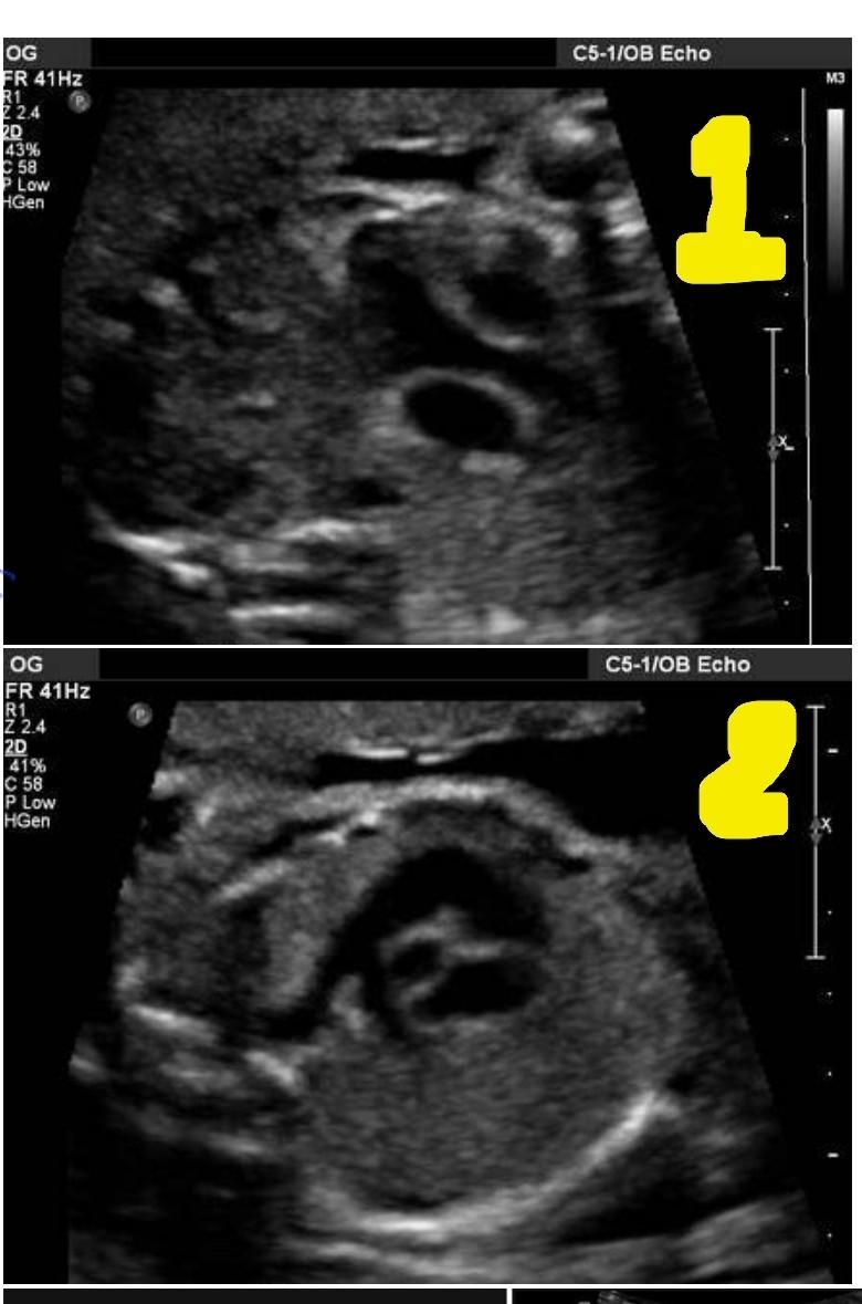 Solved Each ultrasound image has a part of the fetal Biology Diagrams