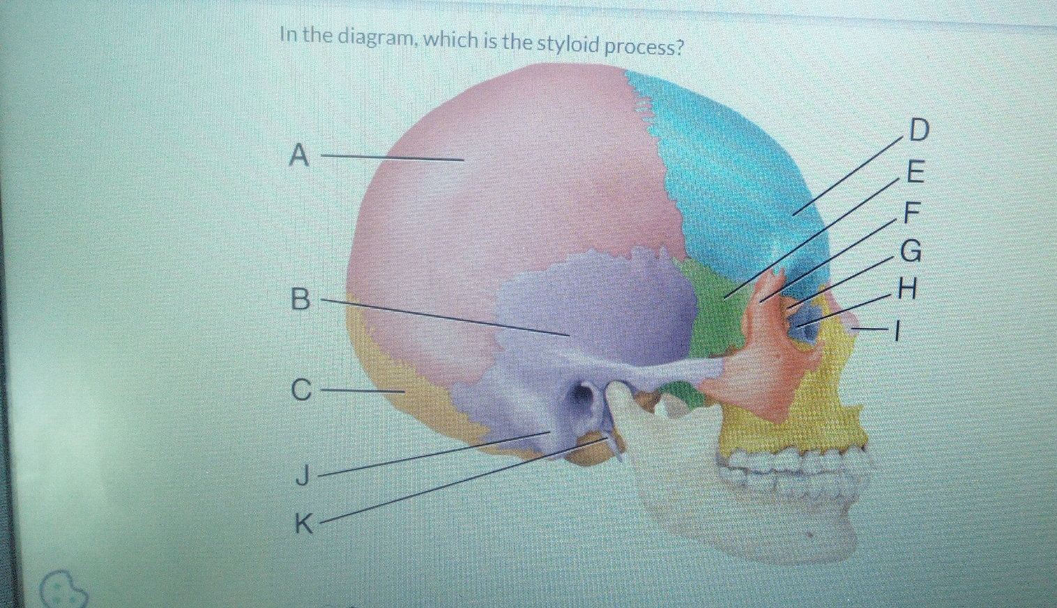 Styloid Process Problem Solved In the diagram, which is the styloid process? | Chegg.com