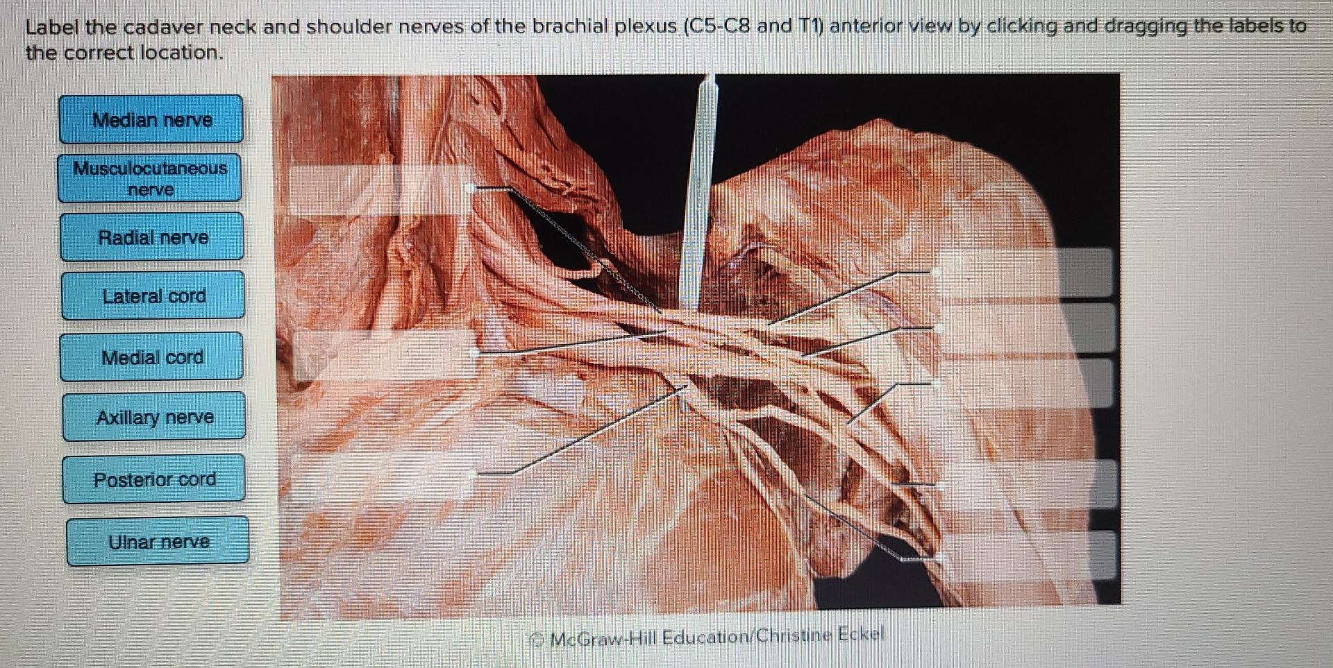 Brachialis Cadaver