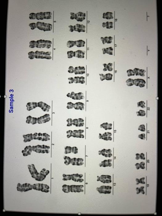 Solved Section B. Compare translocations in patients with | Chegg.com
