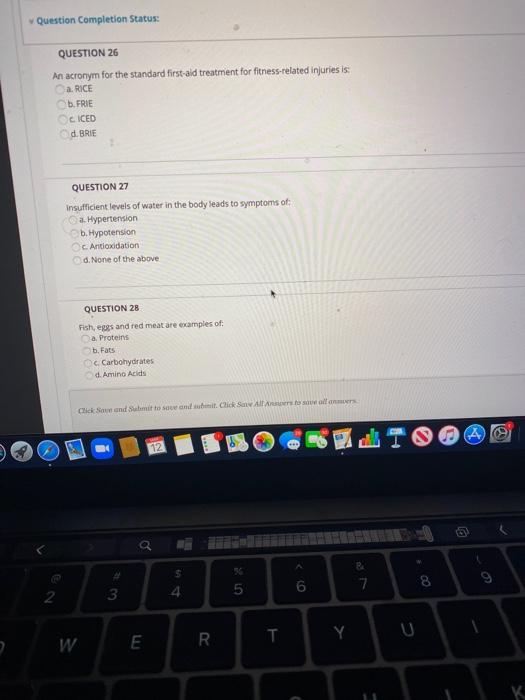 Question Completion Status: QUESTION 26 An acronym for the standard first-aid treatment for fitness-related injuries is: a RI
