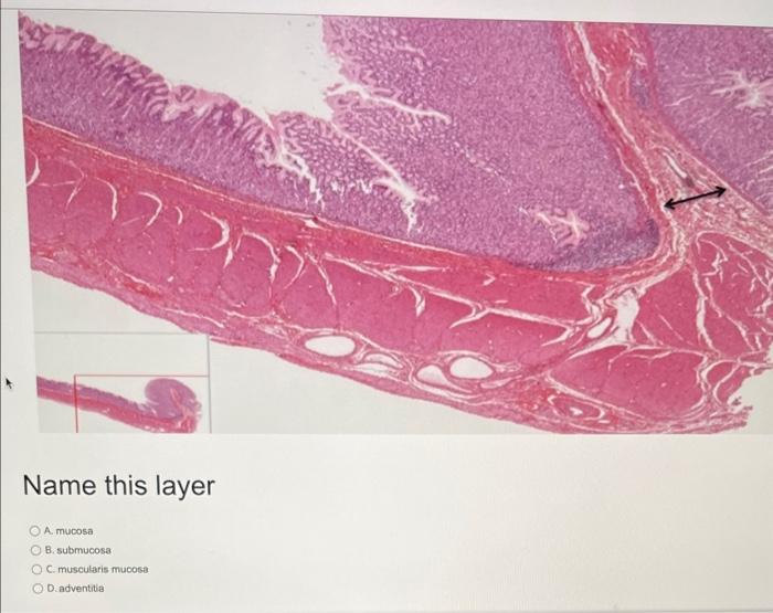 Name this layer A. mucosa B. submucosa C. muscularis mucose D.adventitia