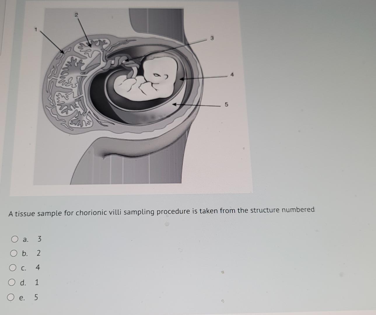 Solved A tissue sample for chorionic villi sampling | Chegg.com
