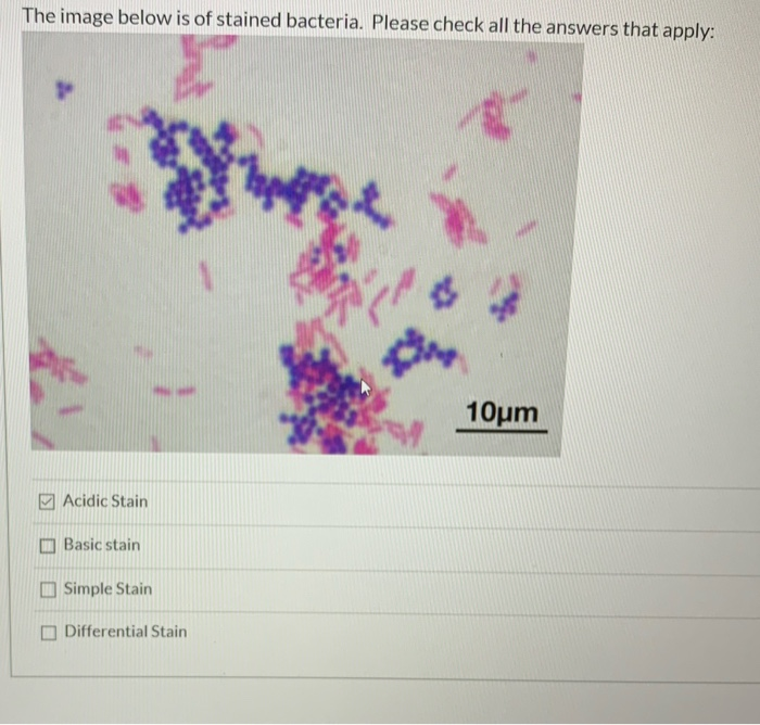 Solved Which type of stain releases and H+ ion simple stain
