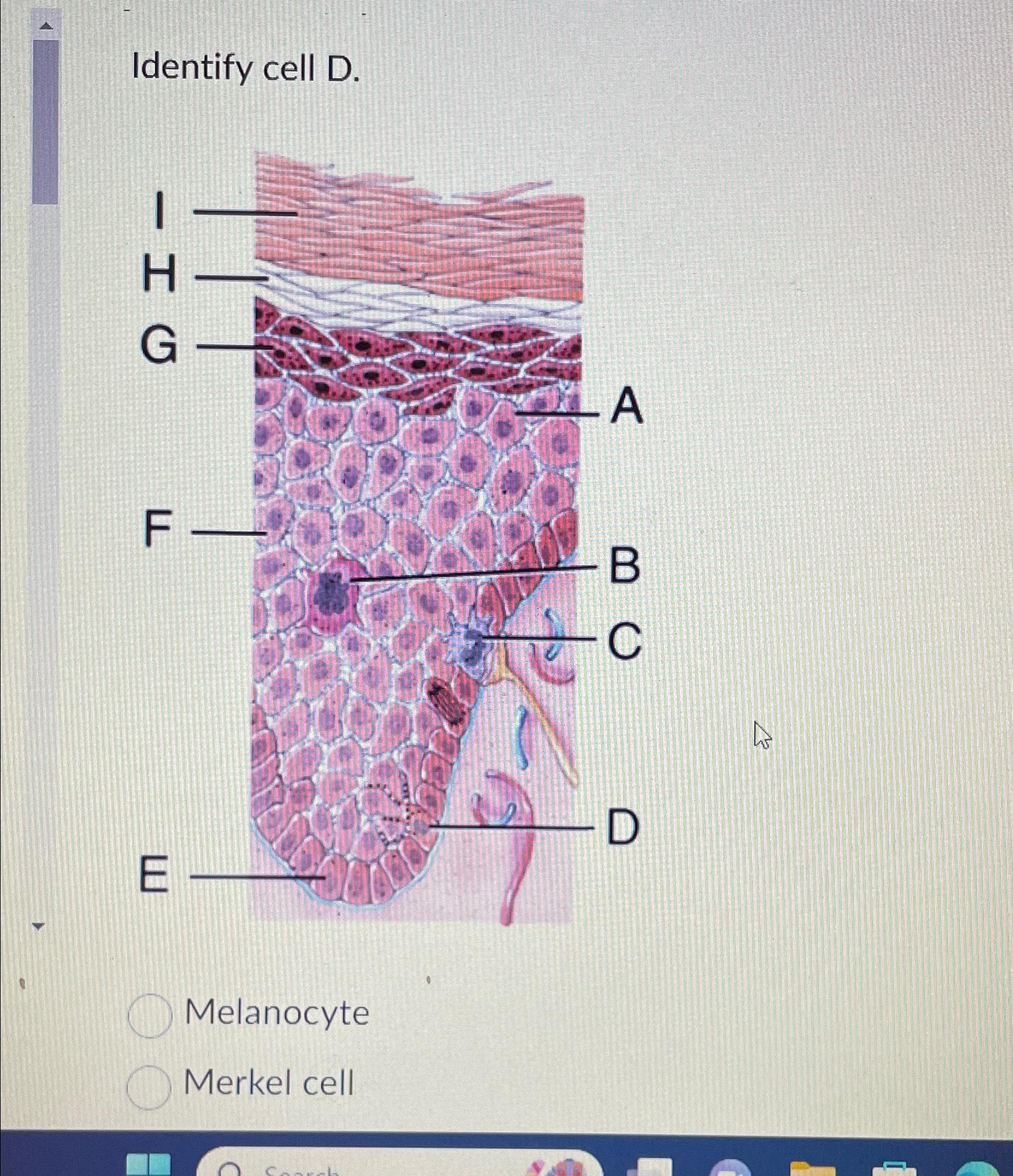 Solved Identify cell D.MelanocyteMerkel cell | Chegg.com